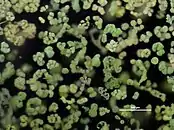 アオコを形成するミクロキスティス属 (Microcystis)