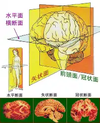 ヒト大脳における平面。