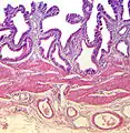 Histology of gallbladder.