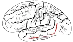 中側頭溝。下側頭回の外側の境界を定める脳溝。