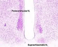 サルの脳の視床下部周辺の冠状断試料。画像中央の空白（第三脳室）の両脇に見える、濃く染まっている部分が室傍核。"Paraventricular N" と書かれている。